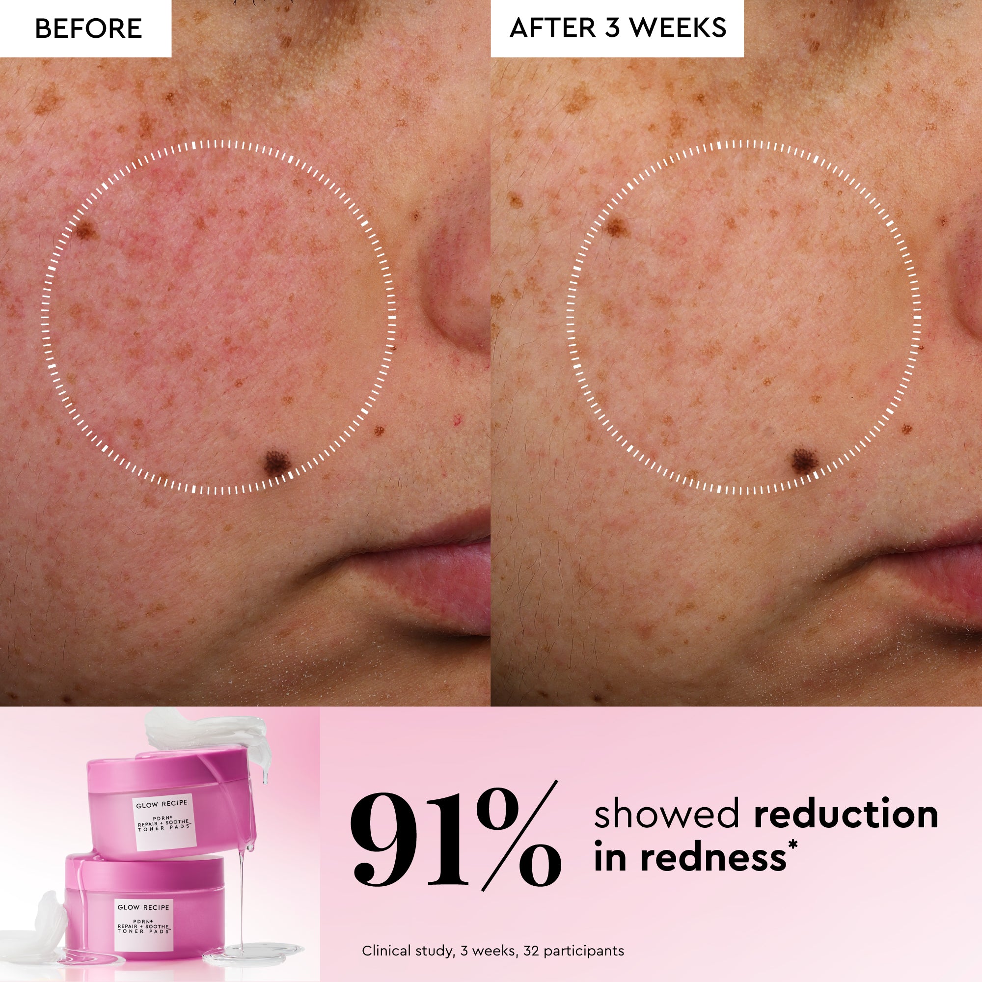 Korean Toner Pad Trial & Travel Kit - Image 6